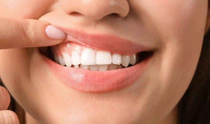 Learn how dental surgeries enhance oral health, relieve pain & improve your smile effectively.