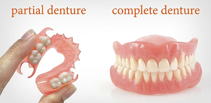 Partial dentures replace some missing teeth; full dentures replace all teeth in upper or lower jaw