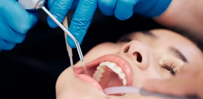 Teeth scaling and polishing procedure showing how often to maintain clean and healthy teeth