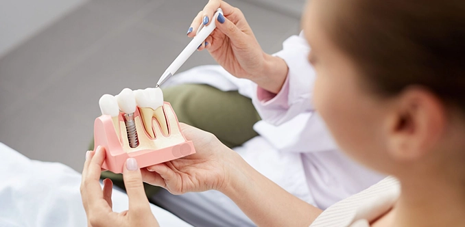 dental implant procedure, healing time, and care tips for strong and lasting teeth.