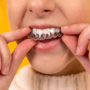Custom dental splint therapy reducing jaw joint stress and teeth grinding in Coimbatore