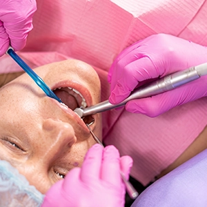 Dental implant used to replace a missing tooth root