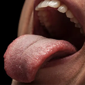 Manage dry mouth conditions that lead to bad breath with proper treatment and guidance to maintain healthy saliva flow.