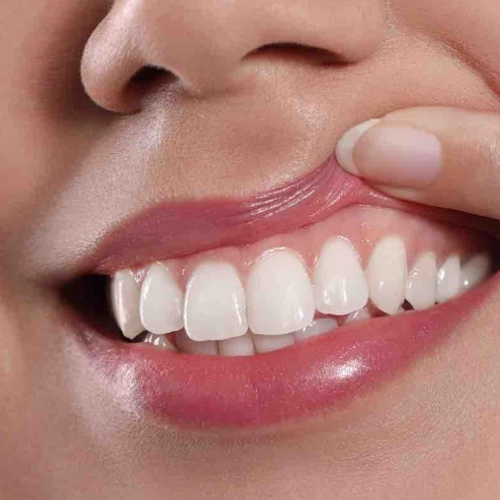 Smoking Reduces Gum Healing Ability