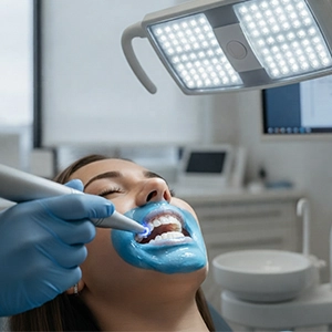 Laser-assisted whitening lightens stains using gel for quicker visual results.