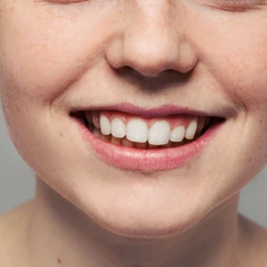 Specialized dental solutions for weakened teeth and fractures in older adults.