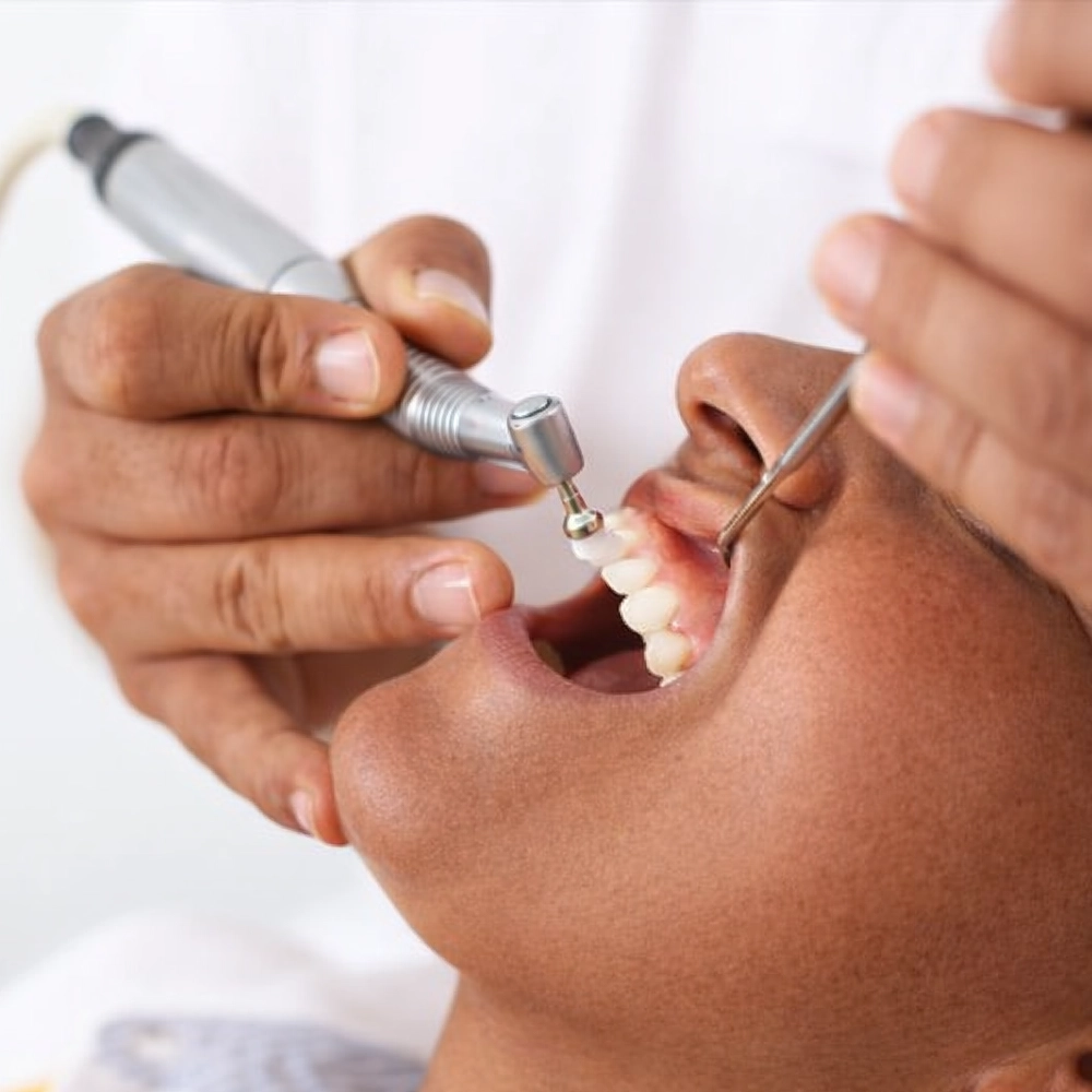 Removes plaque and tartar from the gum line to reduce bleeding, swelling, and early gingivitis.