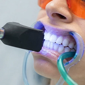 Clinically proven whitening agents safely brighten yellow and stained teeth.