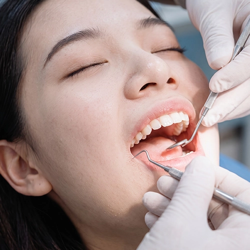 Severe tooth infection making the tooth non-restorable