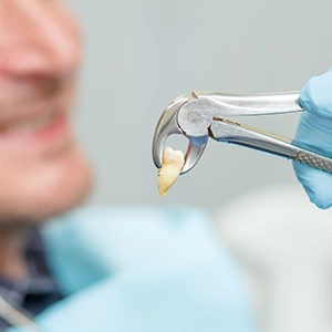 Gentle surgical removal of impacted wisdom teeth ensures fast healing and less discomfort.