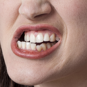 Teeth grinding habit causing jaw joint pressure and TMJ pain in Coimbatore patients