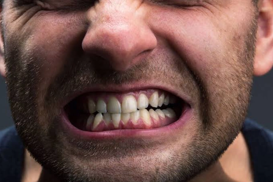 Avoiding Jaw Clenching for TMJ Management