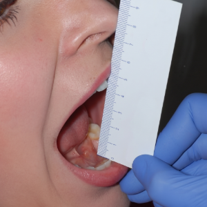 TMJ evaluation examining jaw movement, bite alignment and joint function in Coimbatore
