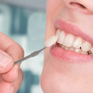 Tooth-coloured dental crown restoring a damaged tooth